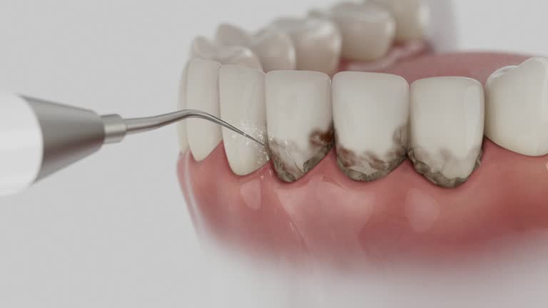 Trusted Dental Crowns And Bridges service in Riverview, MI - Dentist Open Now